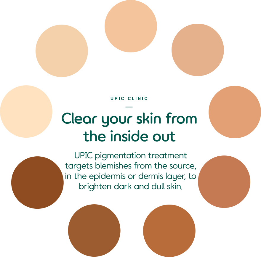 Affordable acne treatment in Seoul - best clinic for breakouts and pigmentation